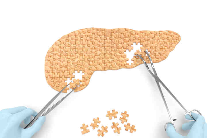 Tumore Del Pancreas La Prevenzione Passa Dalla Dieta