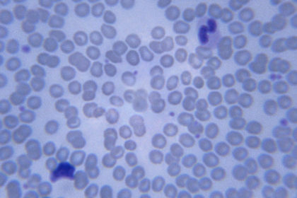I linfociti regolatori: una pallottola magica che ancora non trova la sua strada