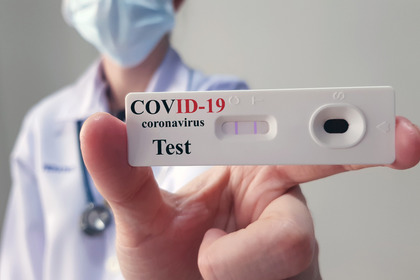 Test sierologici per coronavirus: cosa sono e a cosa servono