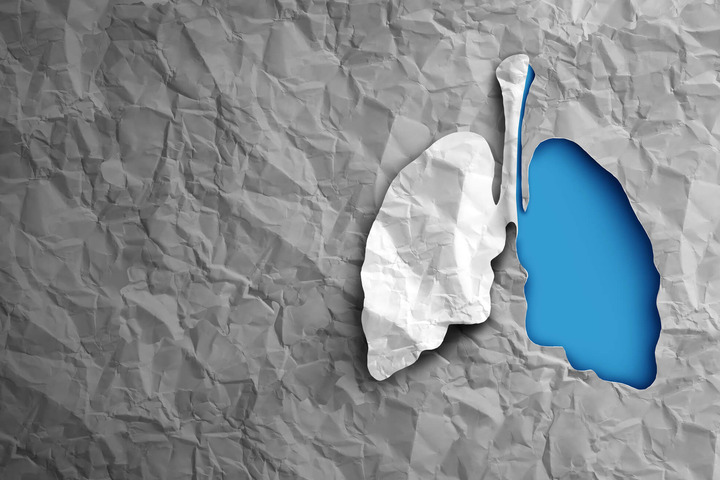 Tumore al polmone: perché si fanno pochi screening? 