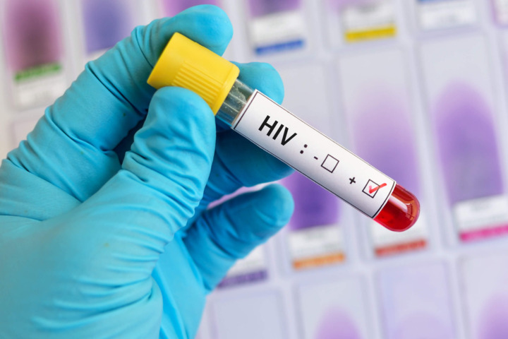 HIV in crescita: tornano i numeri pre-pandemia